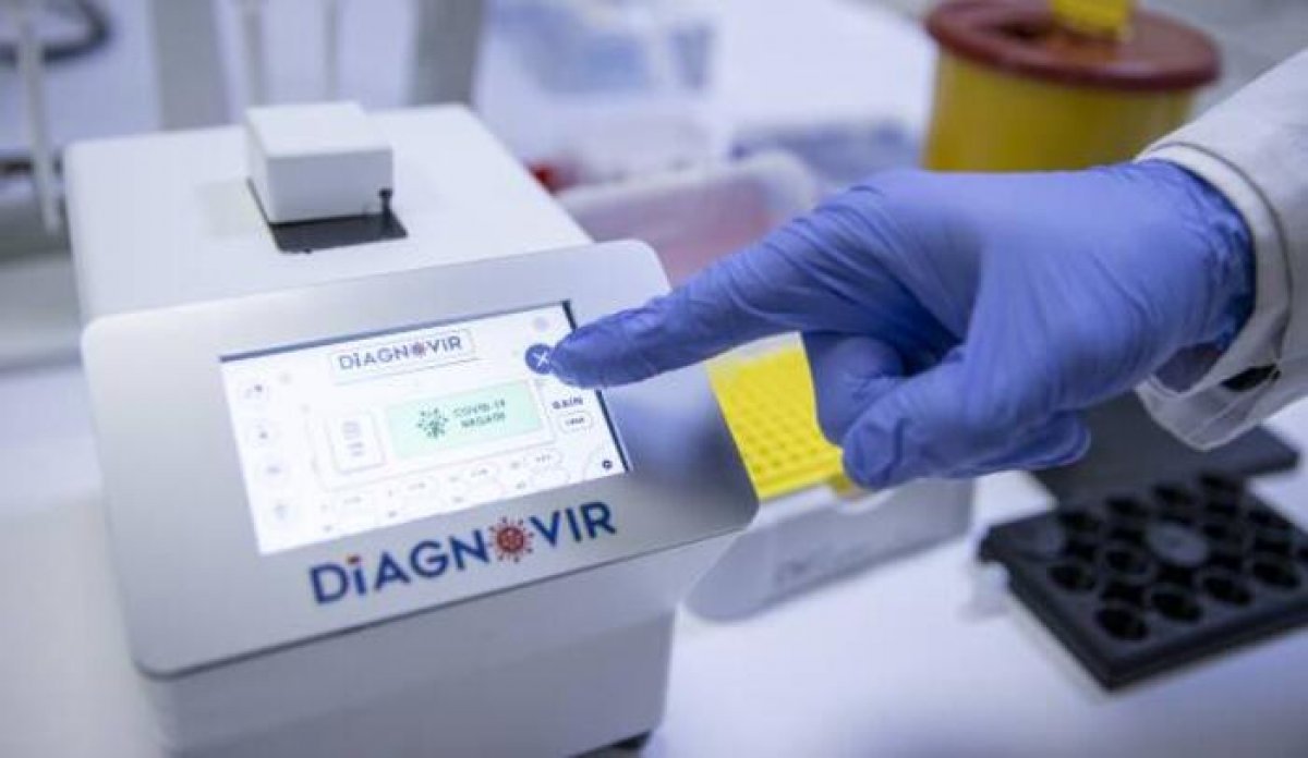 Diagnovir test nedir, nasıl çalışır? Yerli Diagnovir test ne kadar güvenilir?